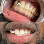 WHITR Instant Whitening Strips