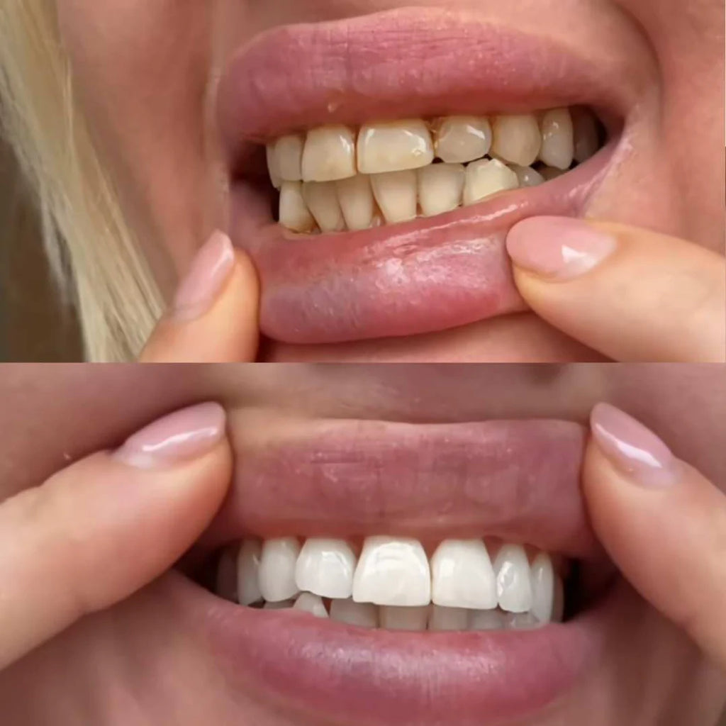 WHITR Instant Whitening Strips