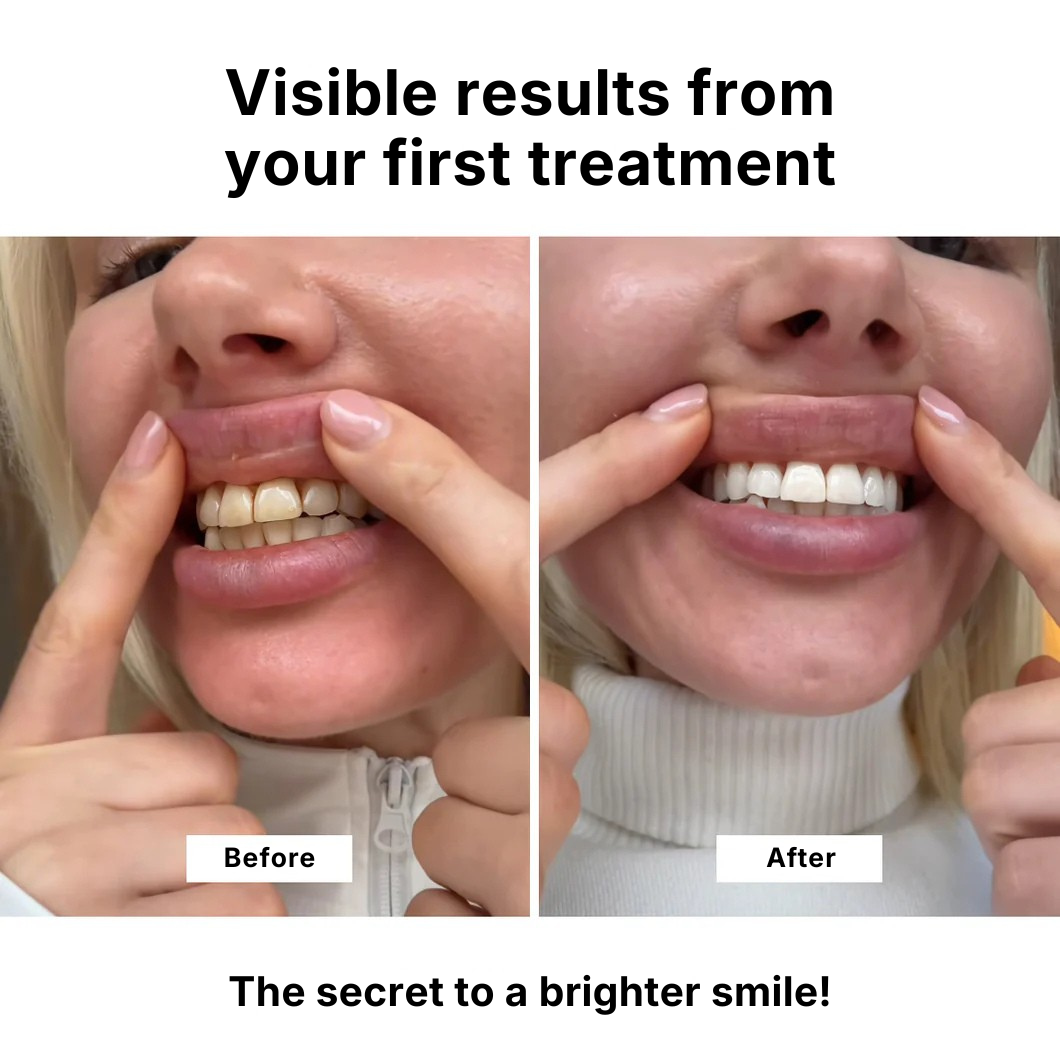 WHITR Instant Whitening Strips