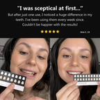 WHITR Instant Whitening Strips