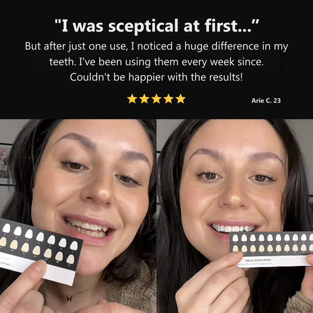 WHITR Instant Whitening Strips